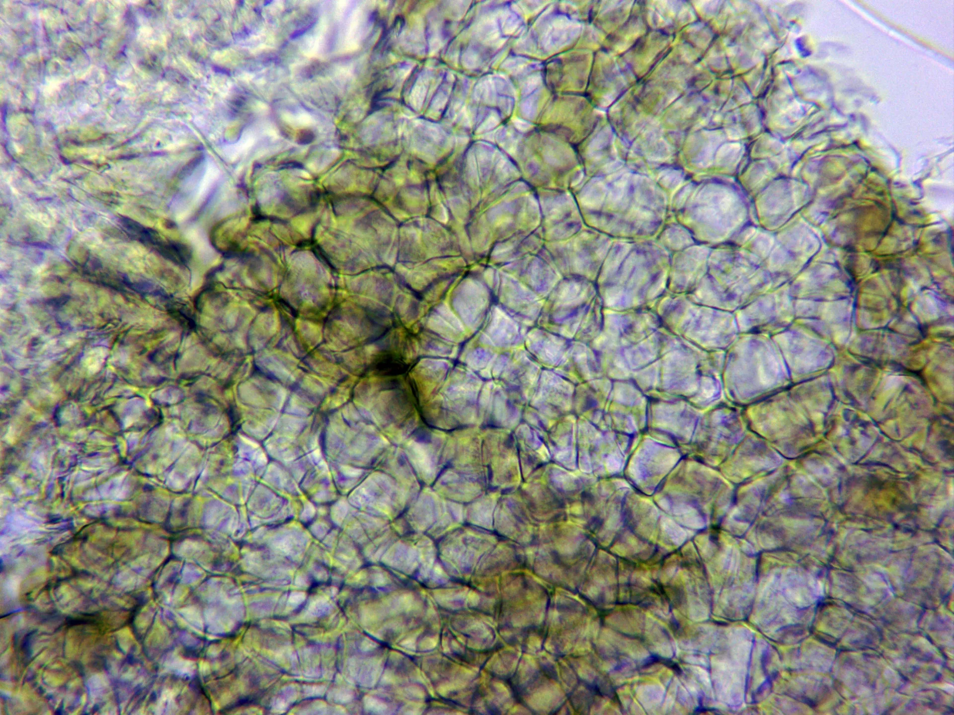 Microscopía de Pseudaleuria fibrillosa - 10 - Excípulo x 400 KOH